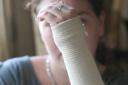 Victim - Kez Everitt-Bronze shows her injured wrist. (80220-1)