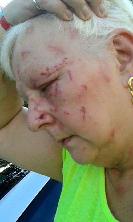 Carol Harvey nearly blinded by dog attack off Mersea Road - 4261154