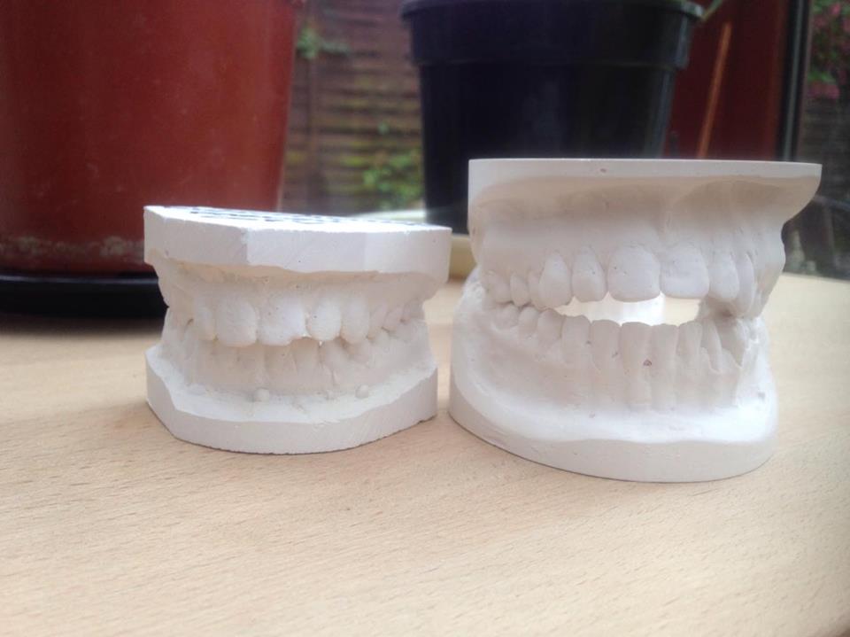 Patient complains: 'My teeth are like something out of The Hills Have Eyes'